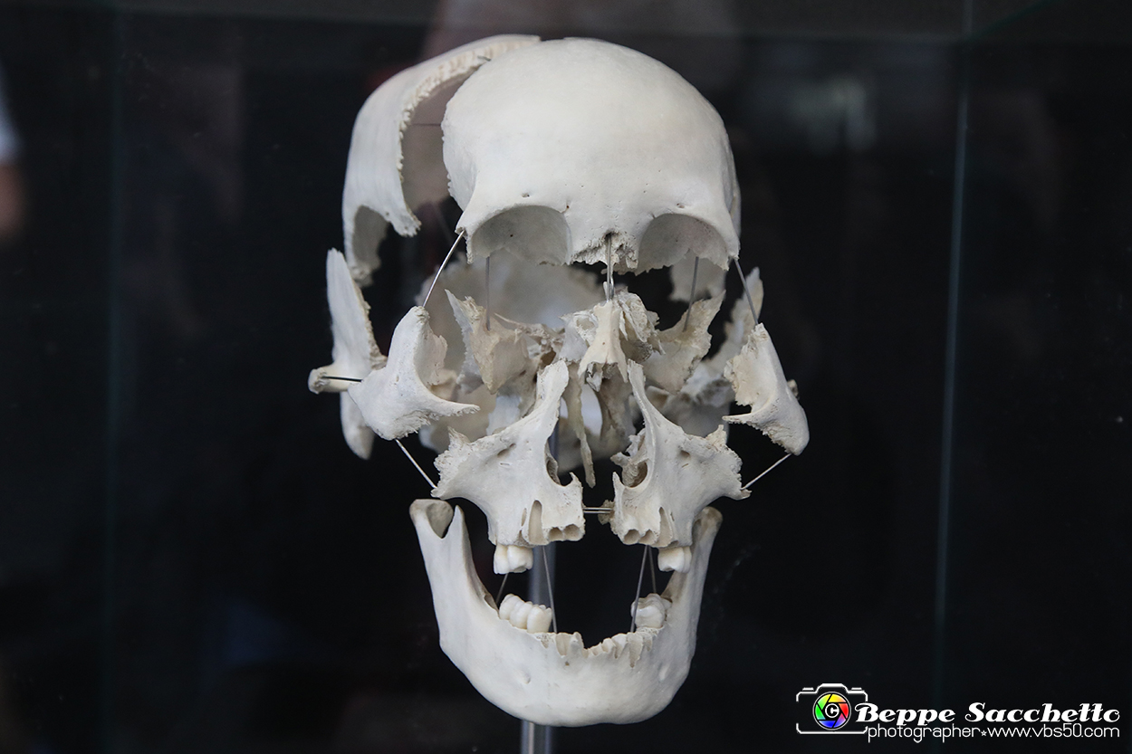 VBS_3116 - Ossa craniche - Mostra Body Worlds.jpg